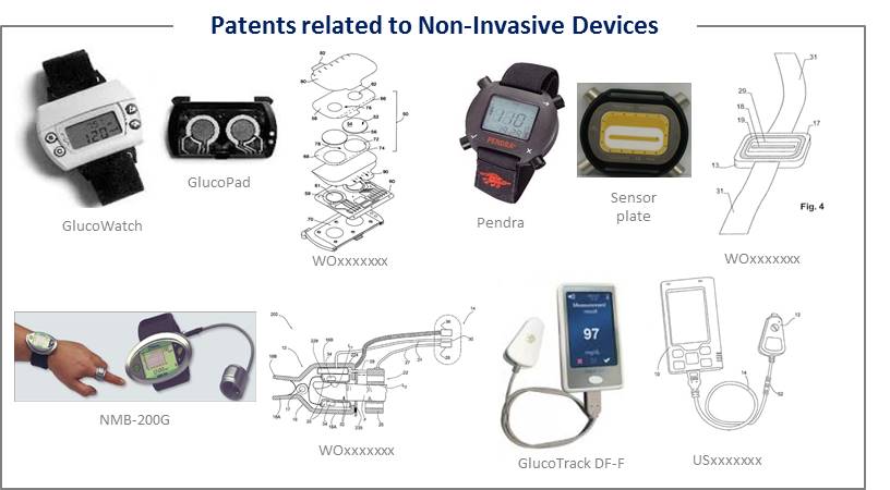 Non-Invasive-Glucose-Monitoring-img1