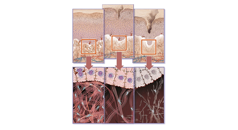Comparison of skin structure at different ages.