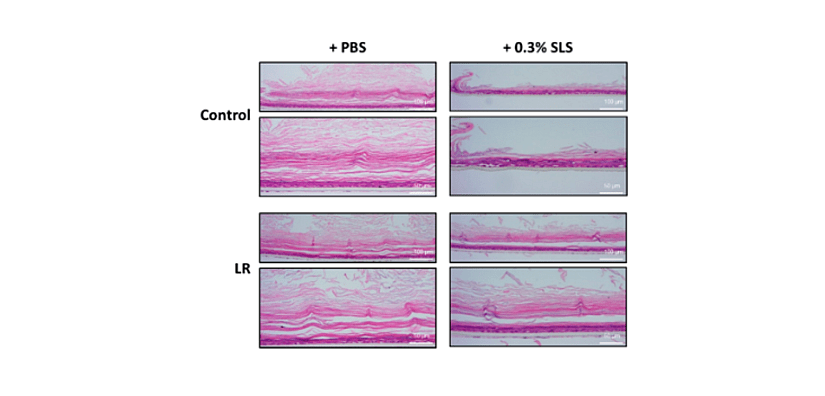 Pictures from Jung et al. study.